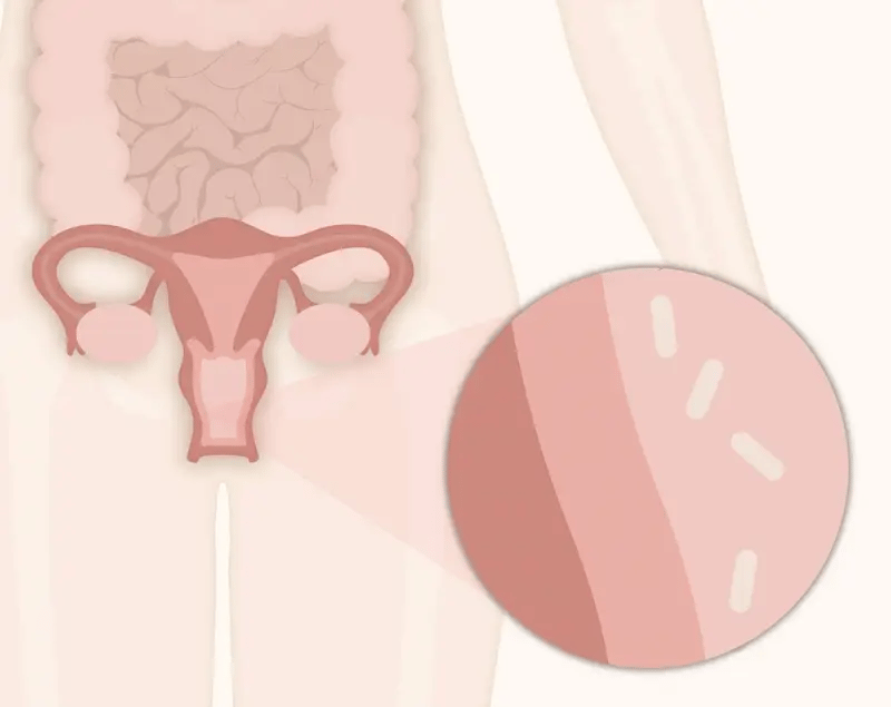 URO Probioticos (salud intima de la mujer, regula PH)
